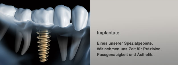 implantate
